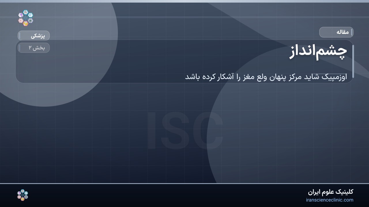 چشم‌انداز